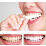 SONRISA IMPECABLE CON UNA CARILLA DENTAL DE ASPECTO NATURAL